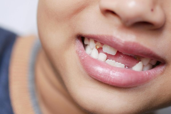 La magie des dents de lait : un monde enchanté pour enfants